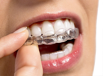 メリット6：ほかの歯への負担が少ない